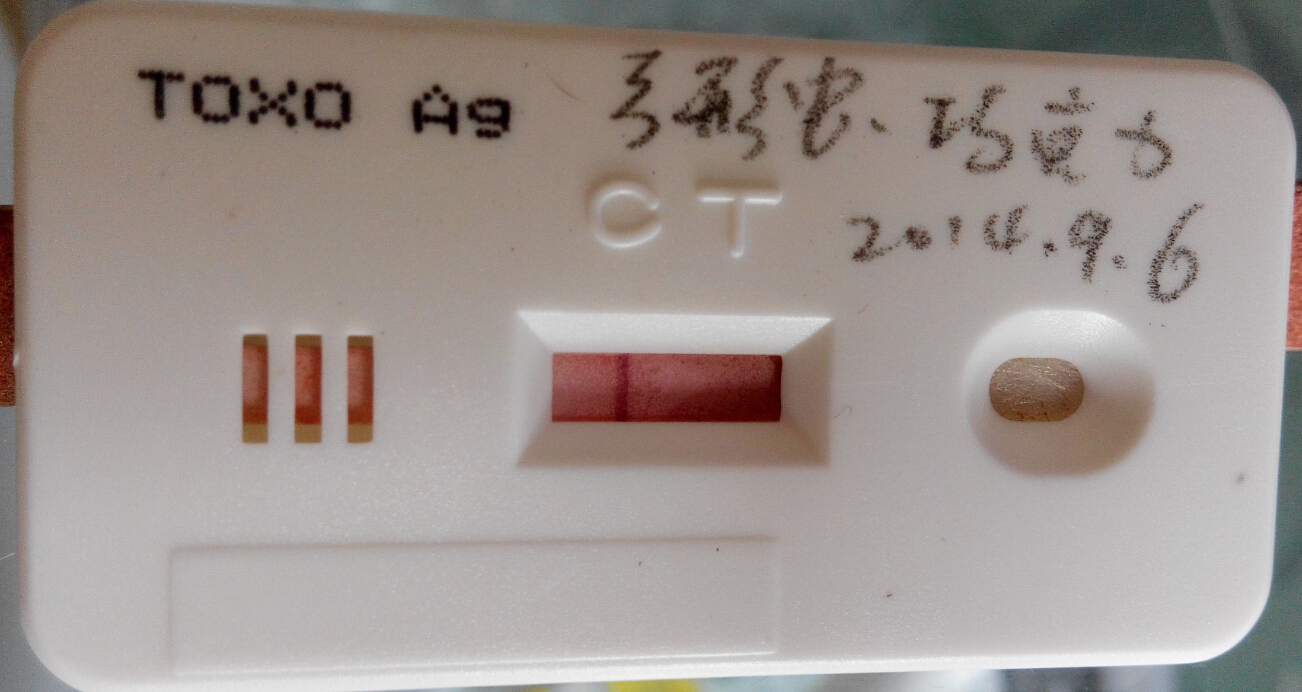 弓形蟲檢測