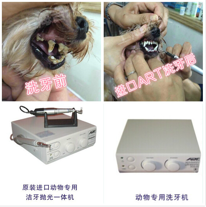 洗牙，潔牙